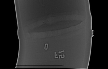 Computed radiographic image of a typical weld